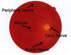 Eye Health Evaluation